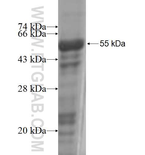 PARD6B fusion protein Ag6025 SDS-PAGE