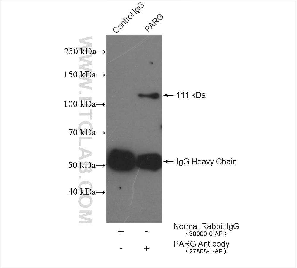 Immunoprecipitation (IP) experiment of mouse testis tissue using PARG Polyclonal antibody (27808-1-AP)