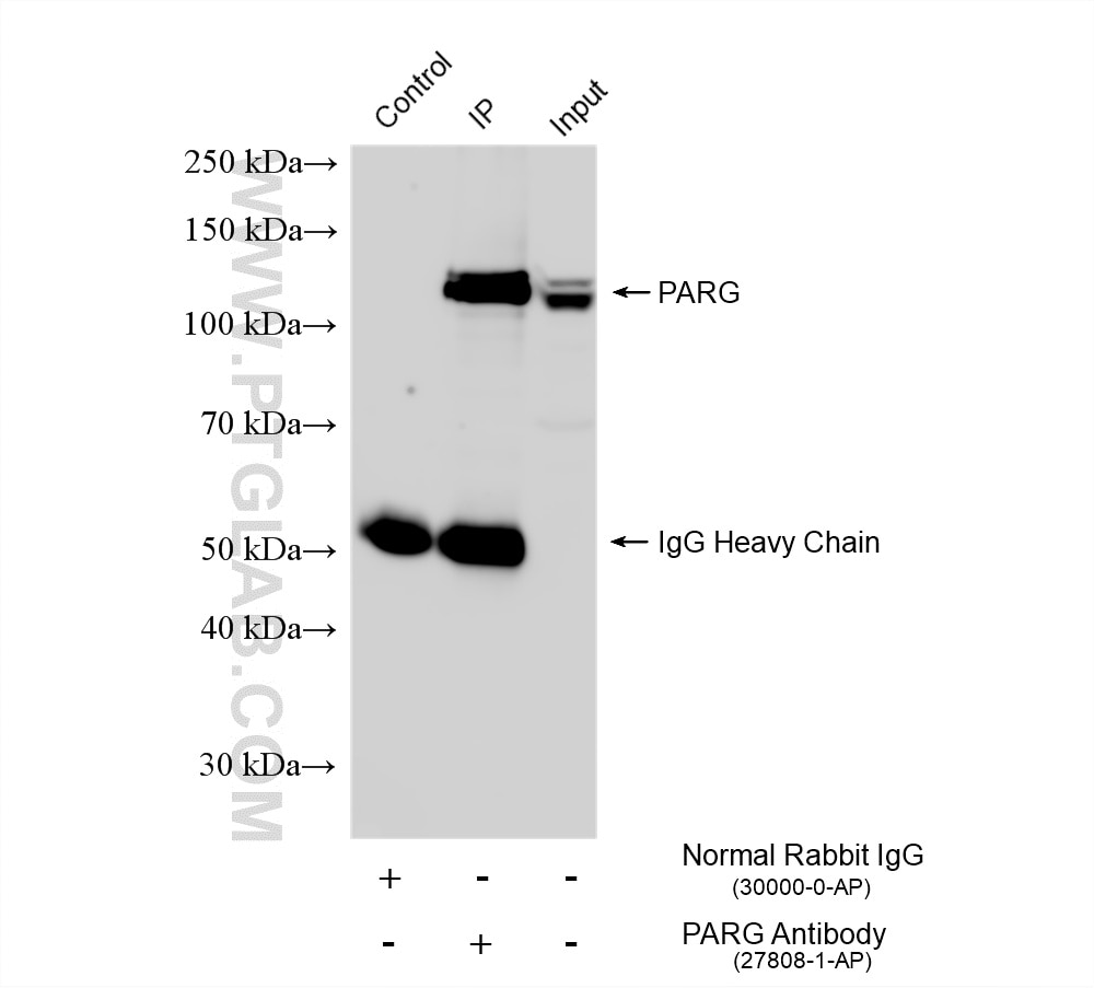Immunoprecipitation (IP) experiment of Jurkat cells using PARG Polyclonal antibody (27808-1-AP)