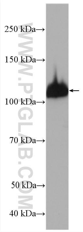 Western Blot (WB) analysis of K-562 cells using PARG Polyclonal antibody (27808-1-AP)
