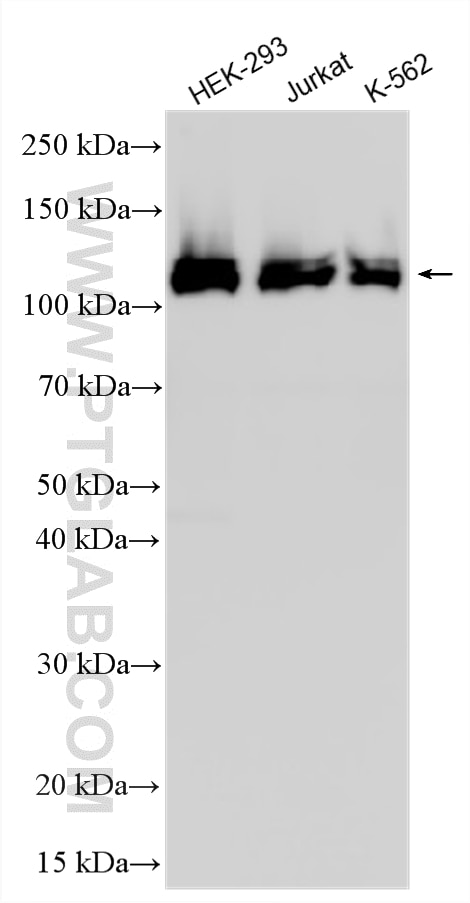 Western Blot (WB) analysis of various lysates using PARG Polyclonal antibody (27808-1-AP)