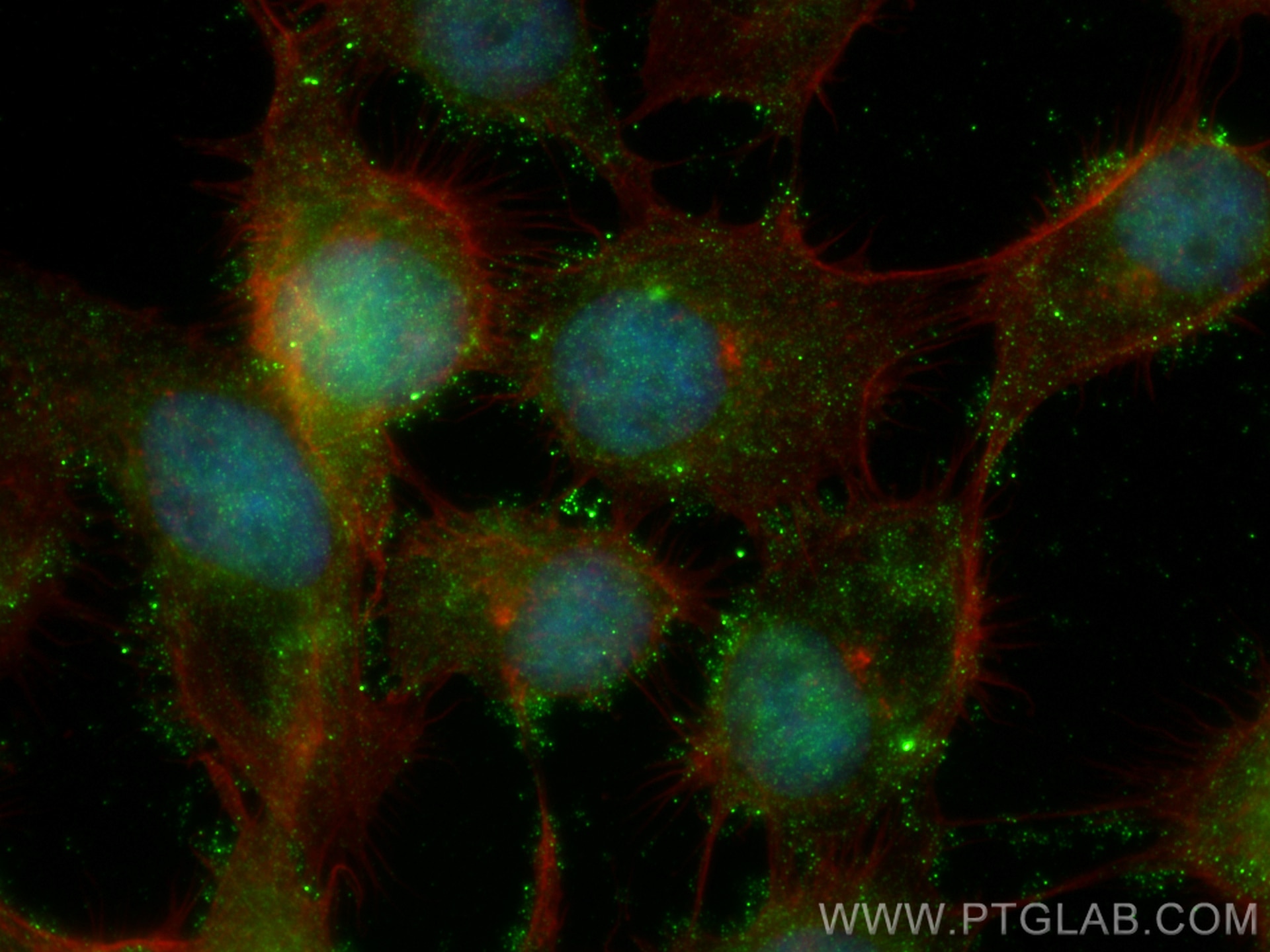 Immunofluorescence (IF) / fluorescent staining of A431 cells using PARG Monoclonal antibody (67946-1-Ig)