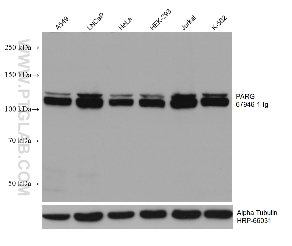 Western Blot (WB) analysis of various lysates using PARG Monoclonal antibody (67946-1-Ig)