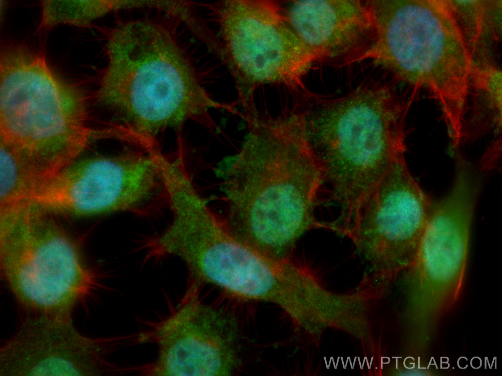Immunofluorescence (IF) / fluorescent staining of A431 cells using CoraLite® Plus 488-conjugated PARG Monoclonal anti (CL488-67946)