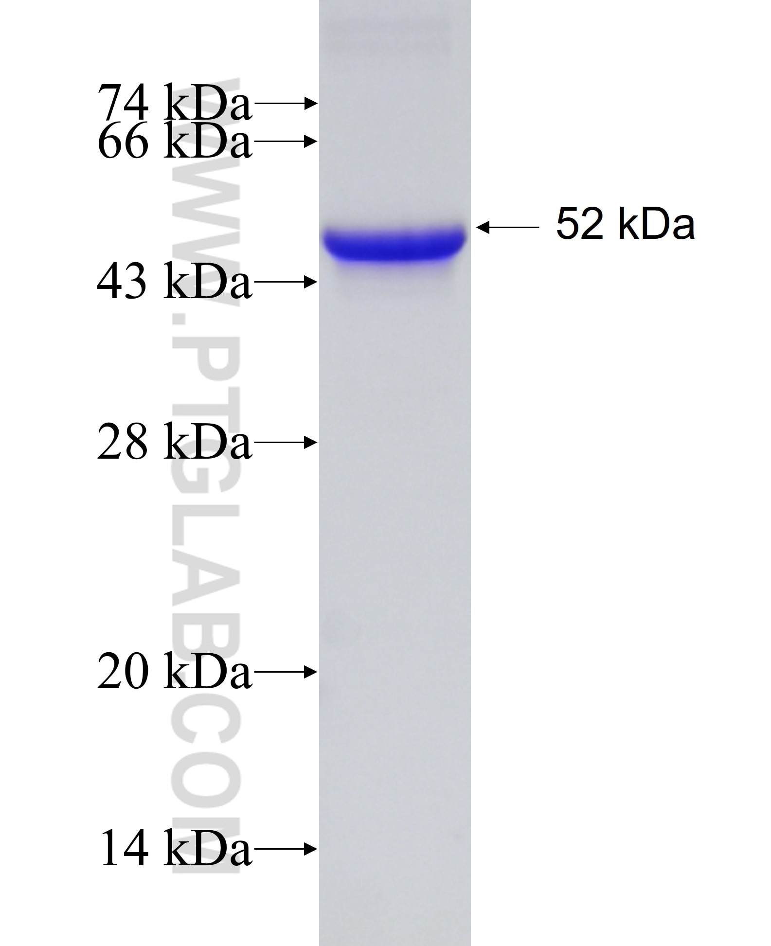 PARG fusion protein Ag27288 SDS-PAGE