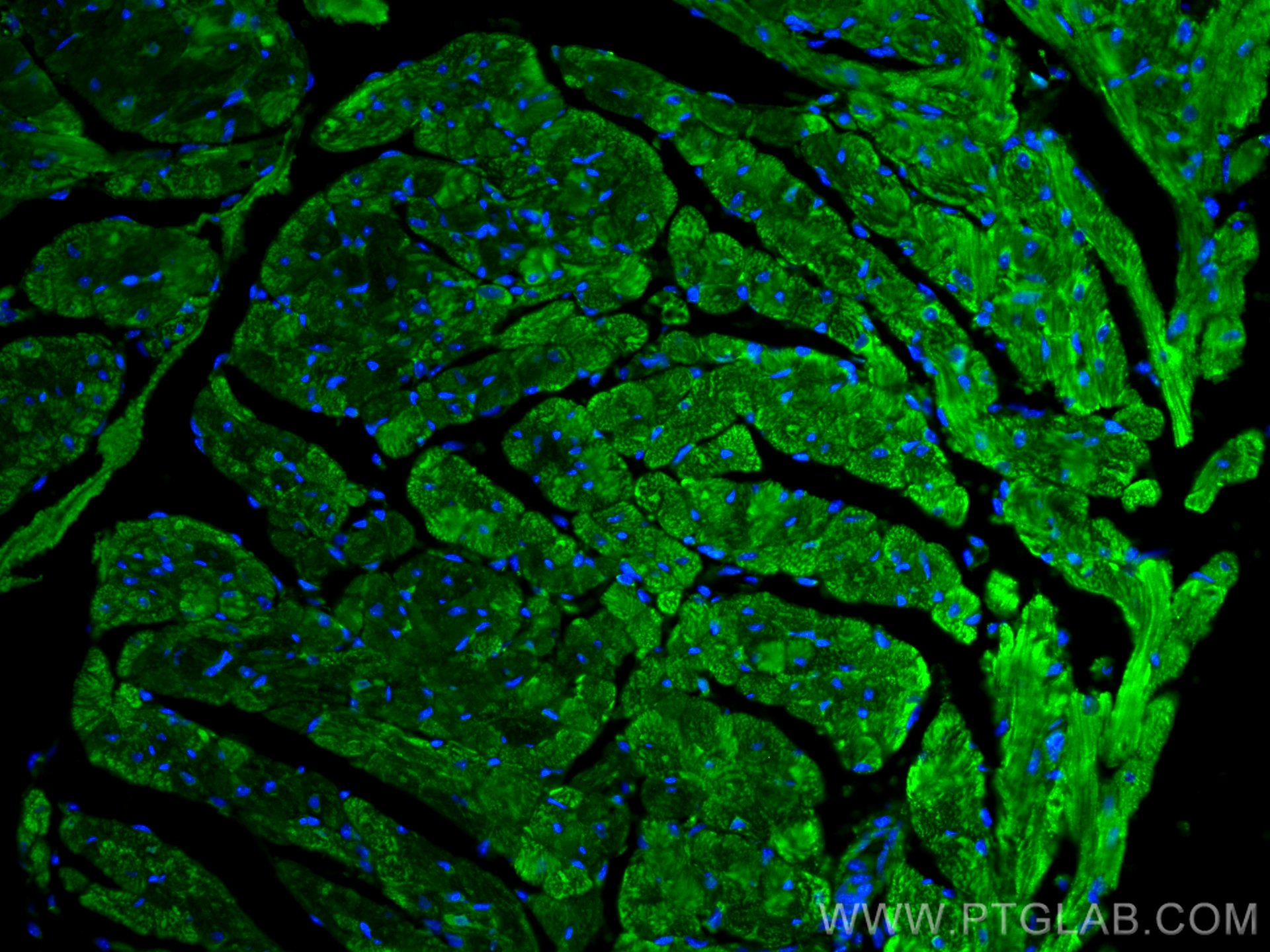 Immunofluorescence (IF) / fluorescent staining of mouse heart tissue using PARK2/Parkin Polyclonal antibody (14060-1-AP)