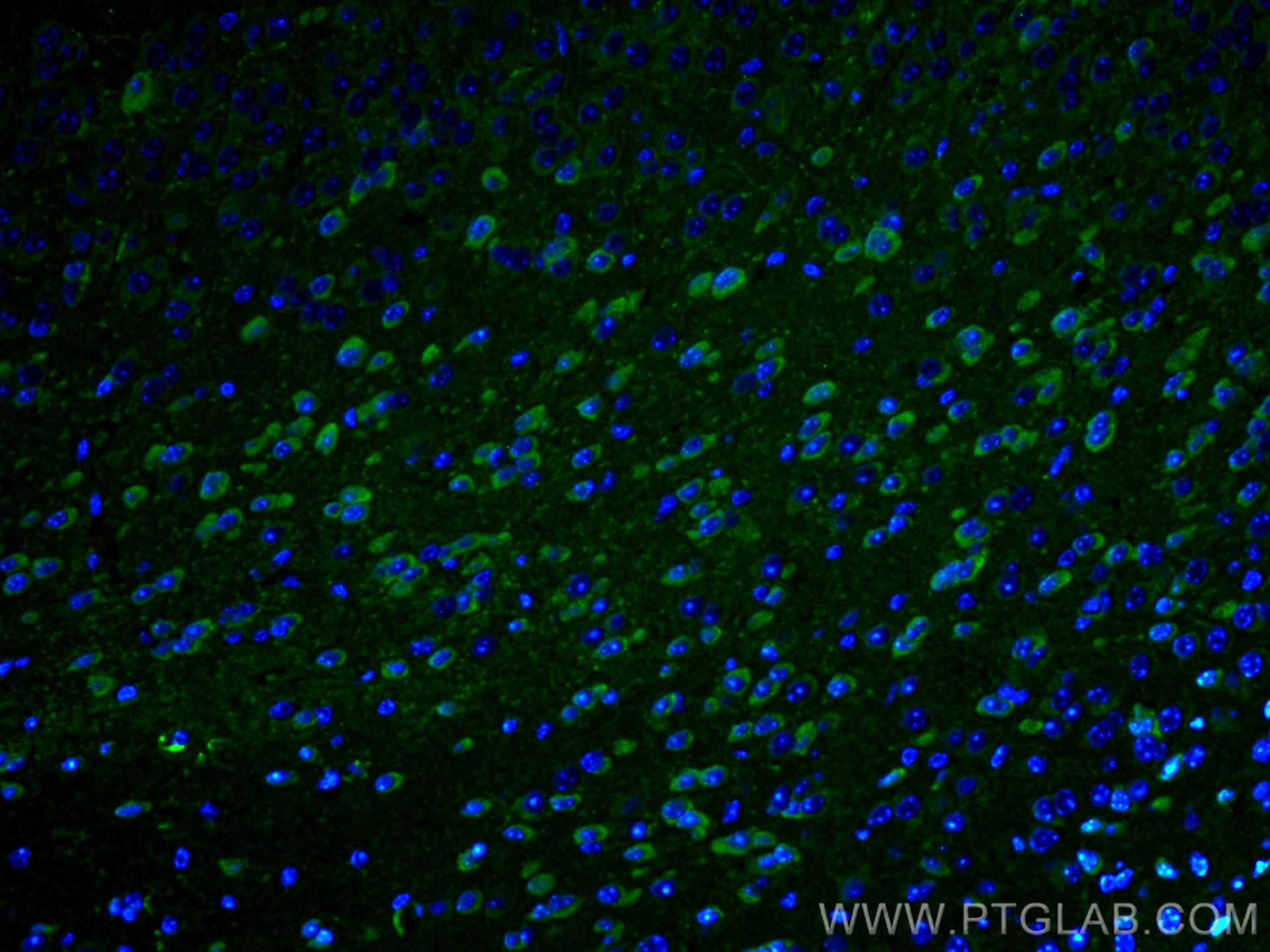 Immunofluorescence (IF) / fluorescent staining of mouse brain tissue using PARK2/Parkin Polyclonal antibody (14060-1-AP)