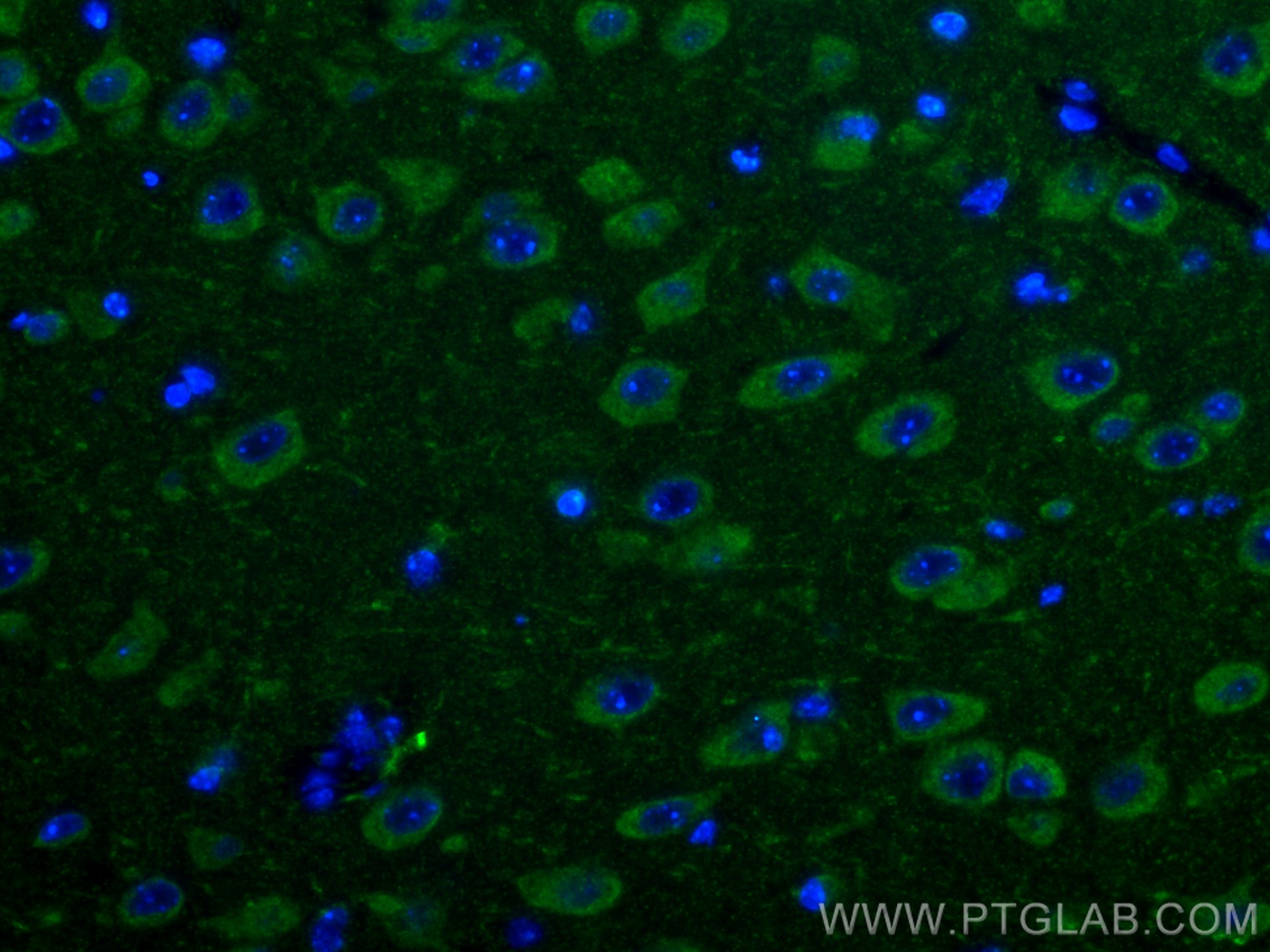Immunofluorescence (IF) / fluorescent staining of mouse brain tissue using PARK2/Parkin Polyclonal antibody (14060-1-AP)