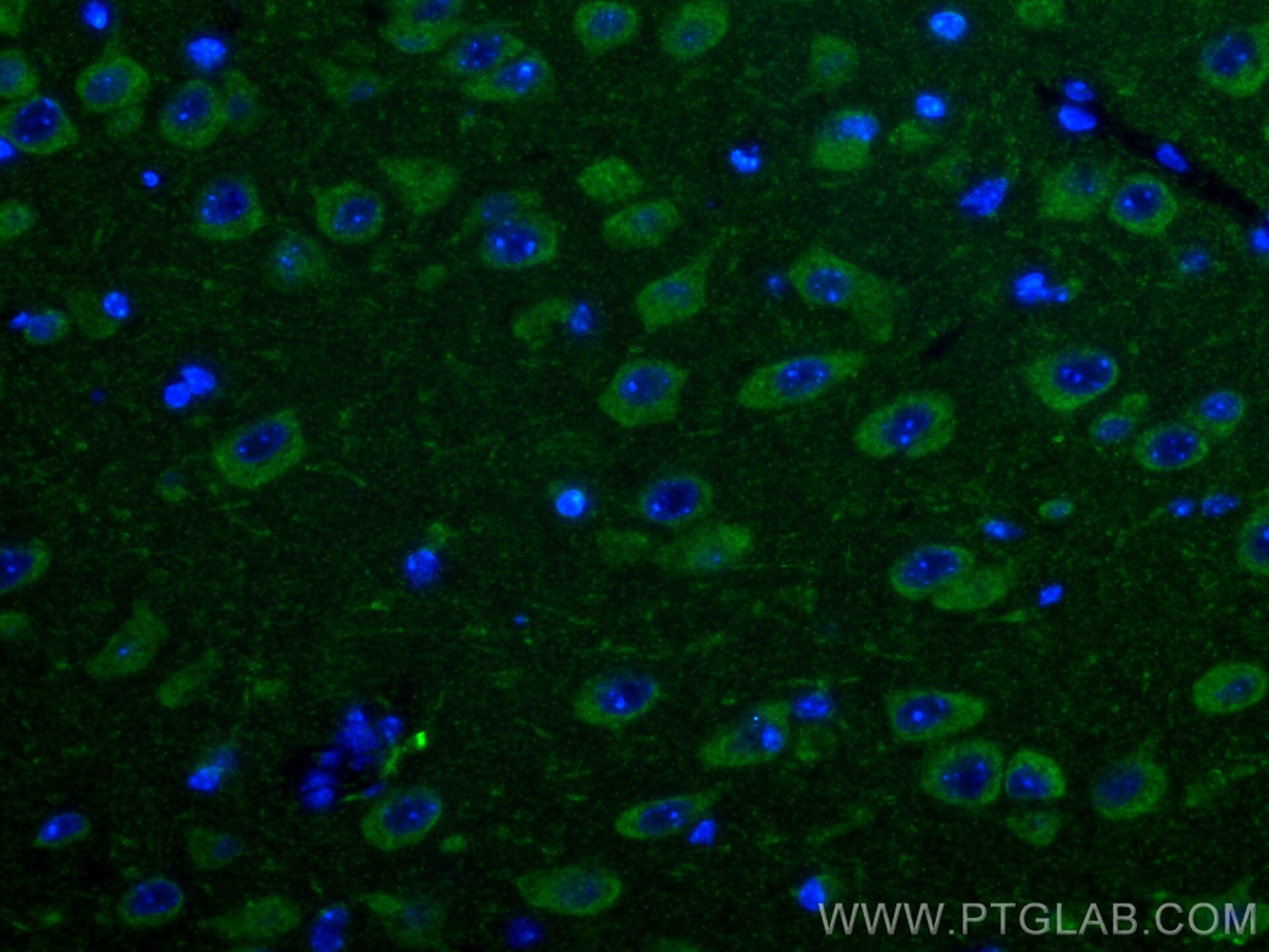 IF Staining of mouse brain using 14060-1-AP