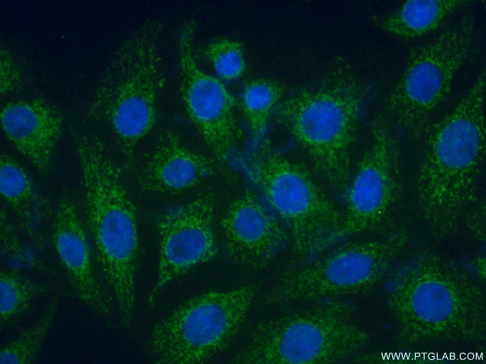 Immunofluorescence (IF) / fluorescent staining of SH-SY5Y cells using PARK2/Parkin Polyclonal antibody (14060-1-AP)