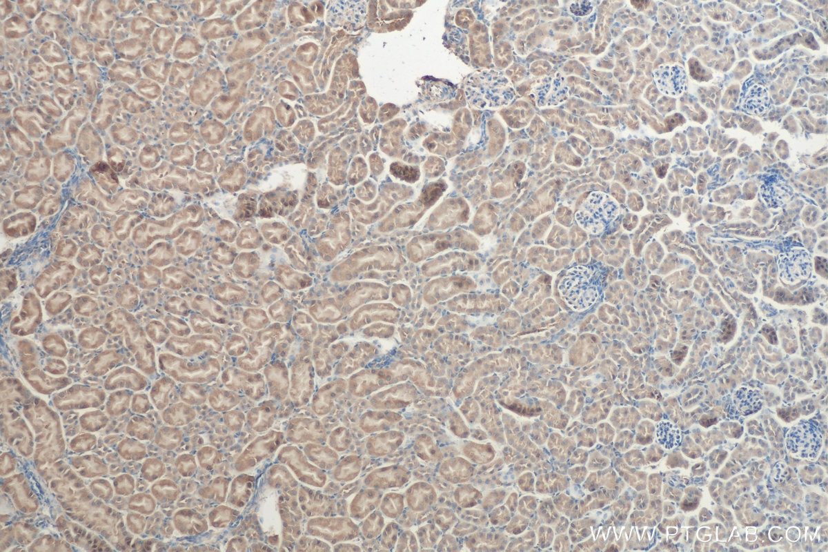 Immunohistochemistry (IHC) staining of mouse kidney tissue using PARK2/Parkin Polyclonal antibody (14060-1-AP)