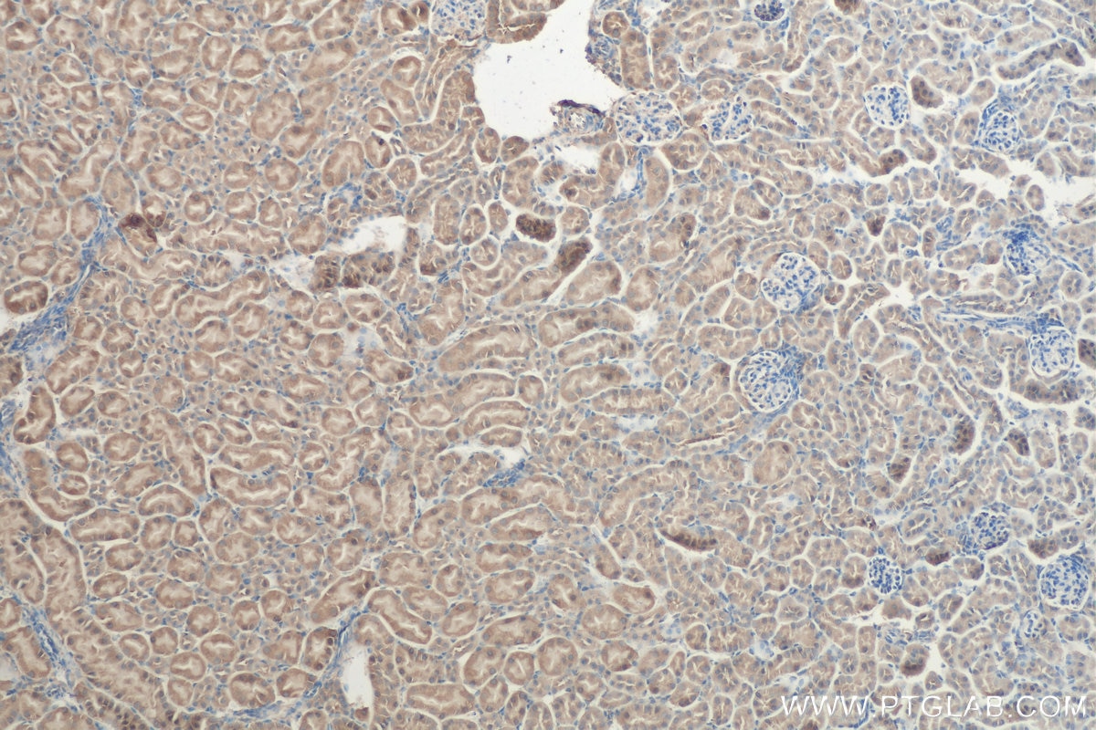 IHC staining of mouse kidney using 14060-1-AP