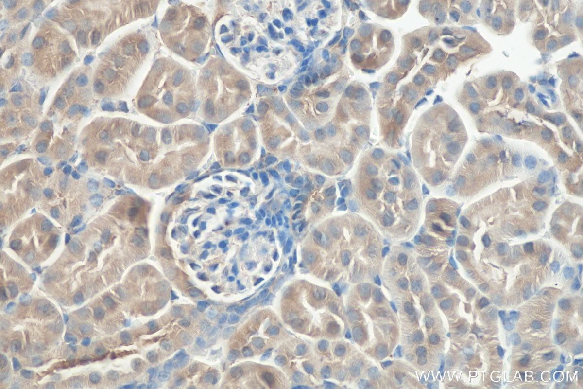 Immunohistochemistry (IHC) staining of mouse kidney tissue using PARK2/Parkin Polyclonal antibody (14060-1-AP)
