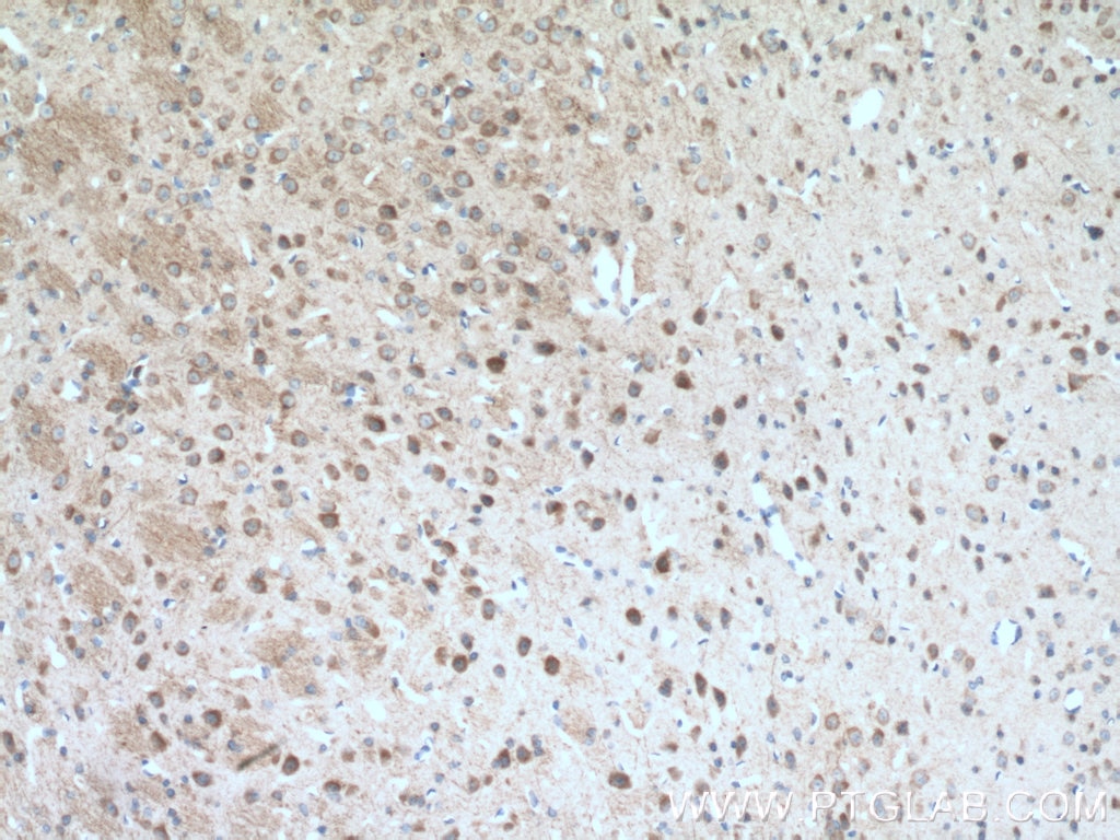 Immunohistochemistry (IHC) staining of mouse brain tissue using PARK2/Parkin Polyclonal antibody (14060-1-AP)