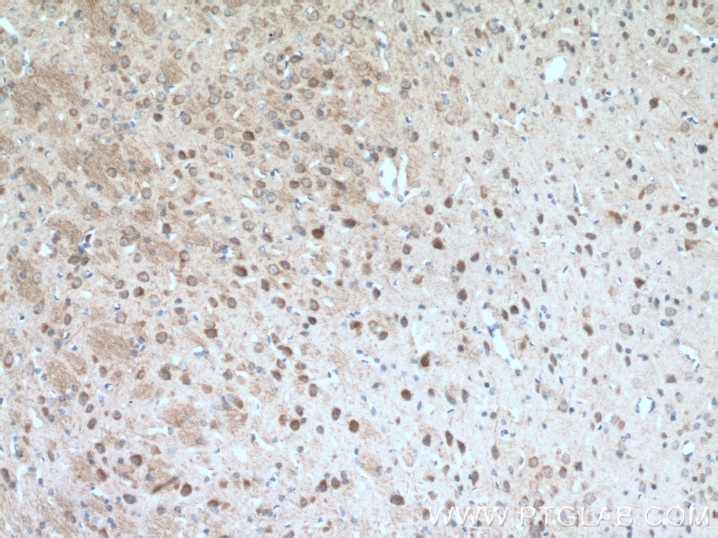 IHC staining of mouse brain using 14060-1-AP