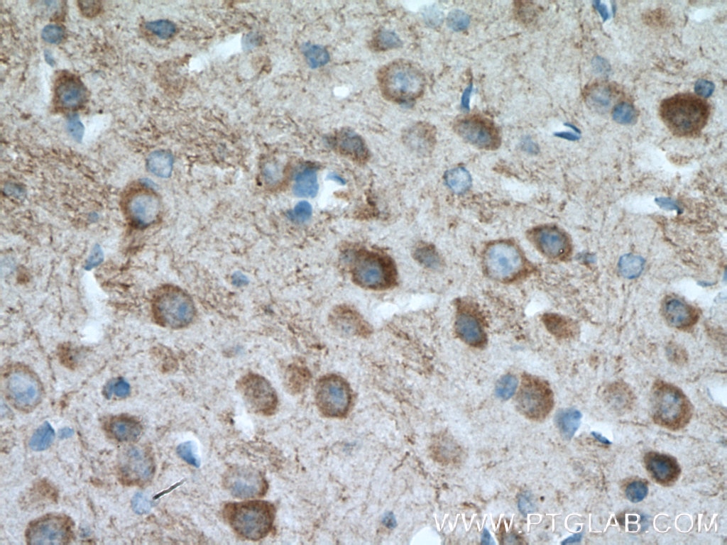 Immunohistochemistry (IHC) staining of mouse brain tissue using PARK2/Parkin Polyclonal antibody (14060-1-AP)