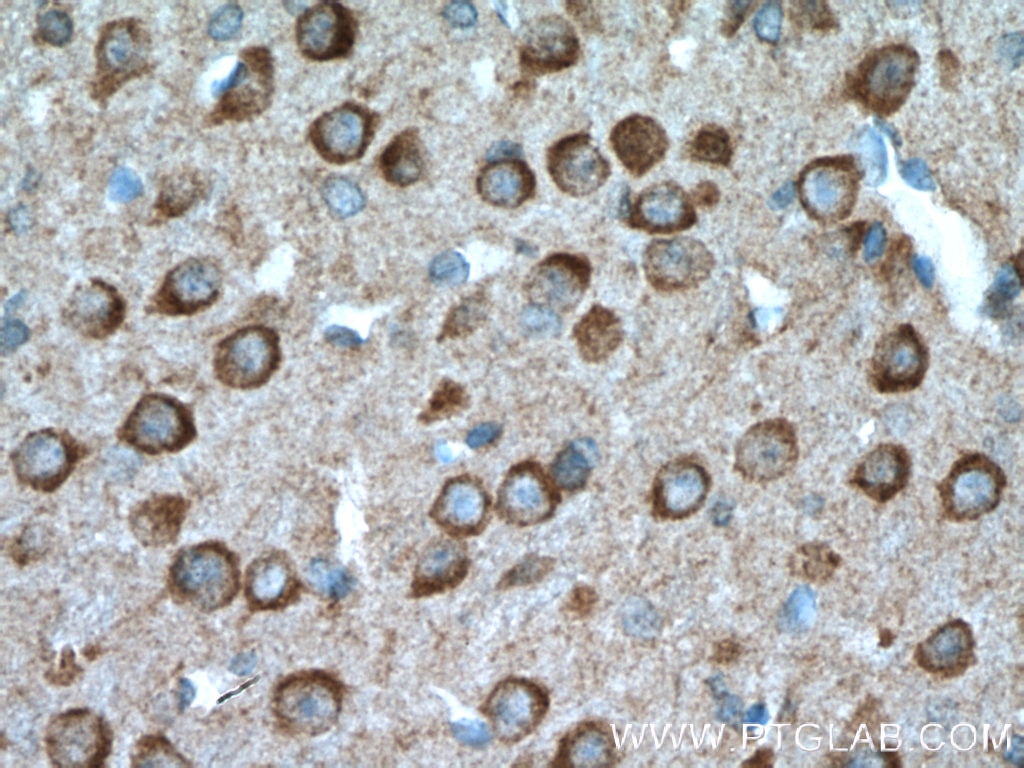 PARK2/Parkin Polyclonal antibody