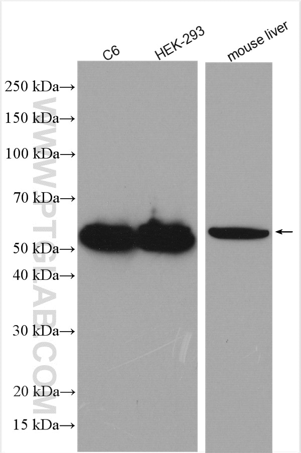 Western Blot (WB) analysis of various lysates using PARK2/Parkin Polyclonal antibody (14060-1-AP)