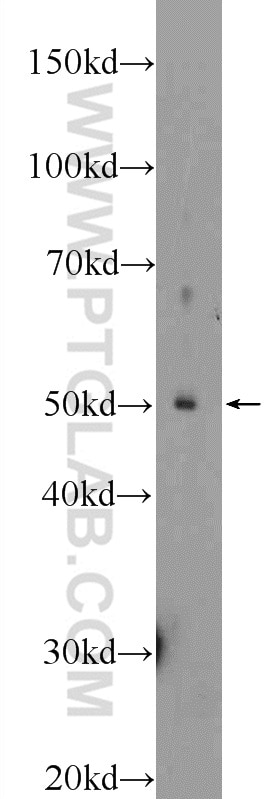 Western Blot (WB) analysis of mouse brain tissue using PARK2/Parkin Polyclonal antibody (14060-1-AP)