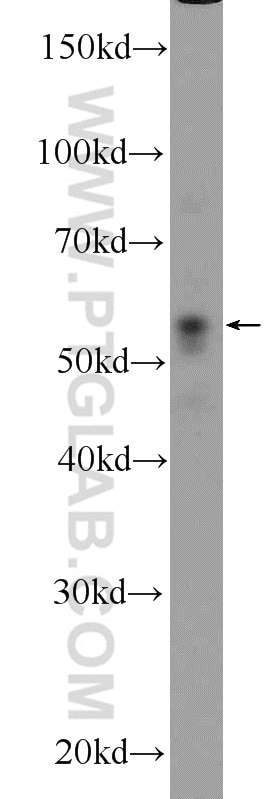 Western Blot (WB) analysis of SH-SY5Y cells using PARK2/Parkin Polyclonal antibody (14060-1-AP)