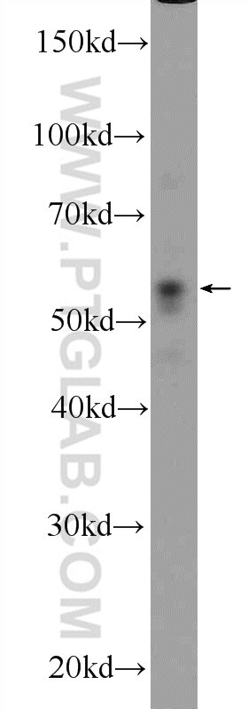 WB analysis of SH-SY5Y using 14060-1-AP