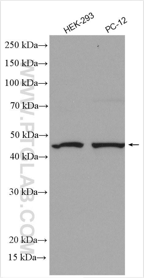 Western Blot (WB) analysis of various lysates using PARK2/Parkin Polyclonal antibody (14060-1-AP)