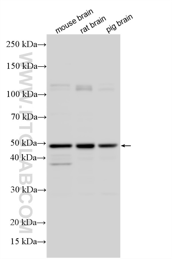 Western Blot (WB) analysis of various lysates using PARK2/Parkin Polyclonal antibody (14060-1-AP)