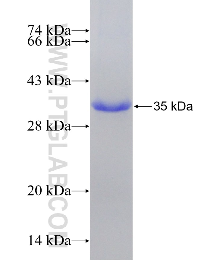 Parkin fusion protein Ag5179 SDS-PAGE