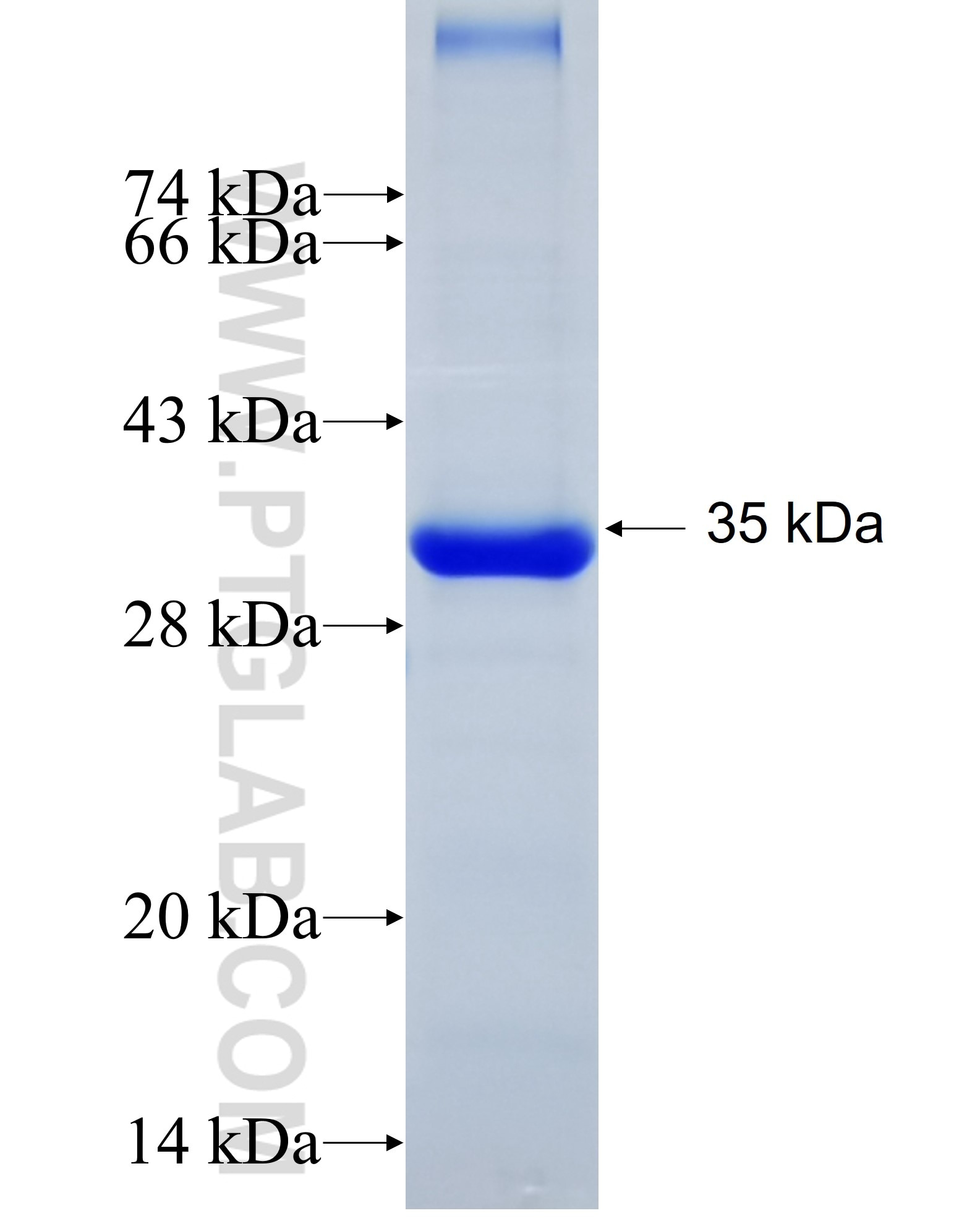 Parkin fusion protein Ag5179 SDS-PAGE