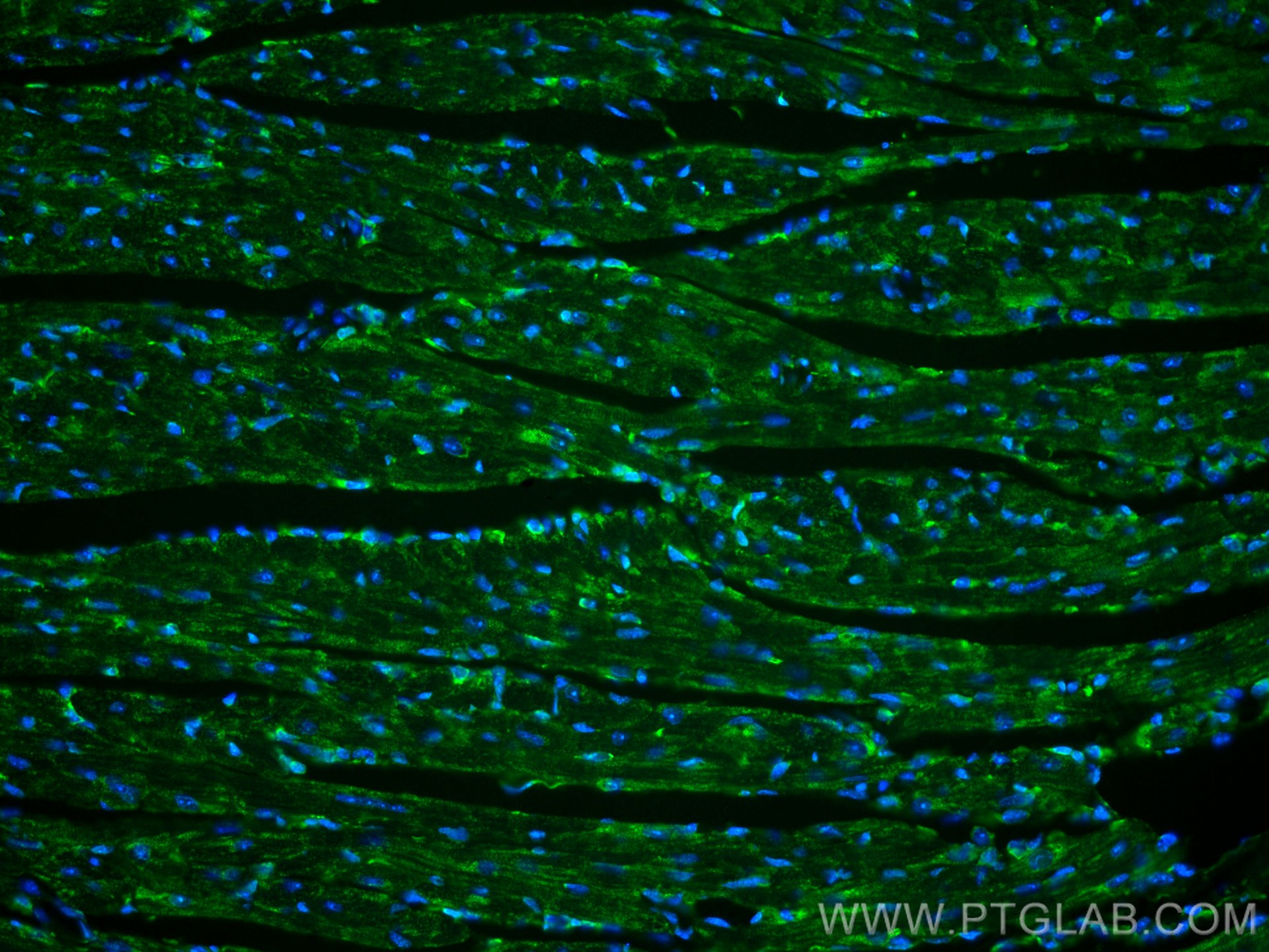 Immunofluorescence (IF) / fluorescent staining of mouse heart tissue using CoraLite® Plus 488-conjugated PARK2/Parkin Polyclo (CL488-14060)