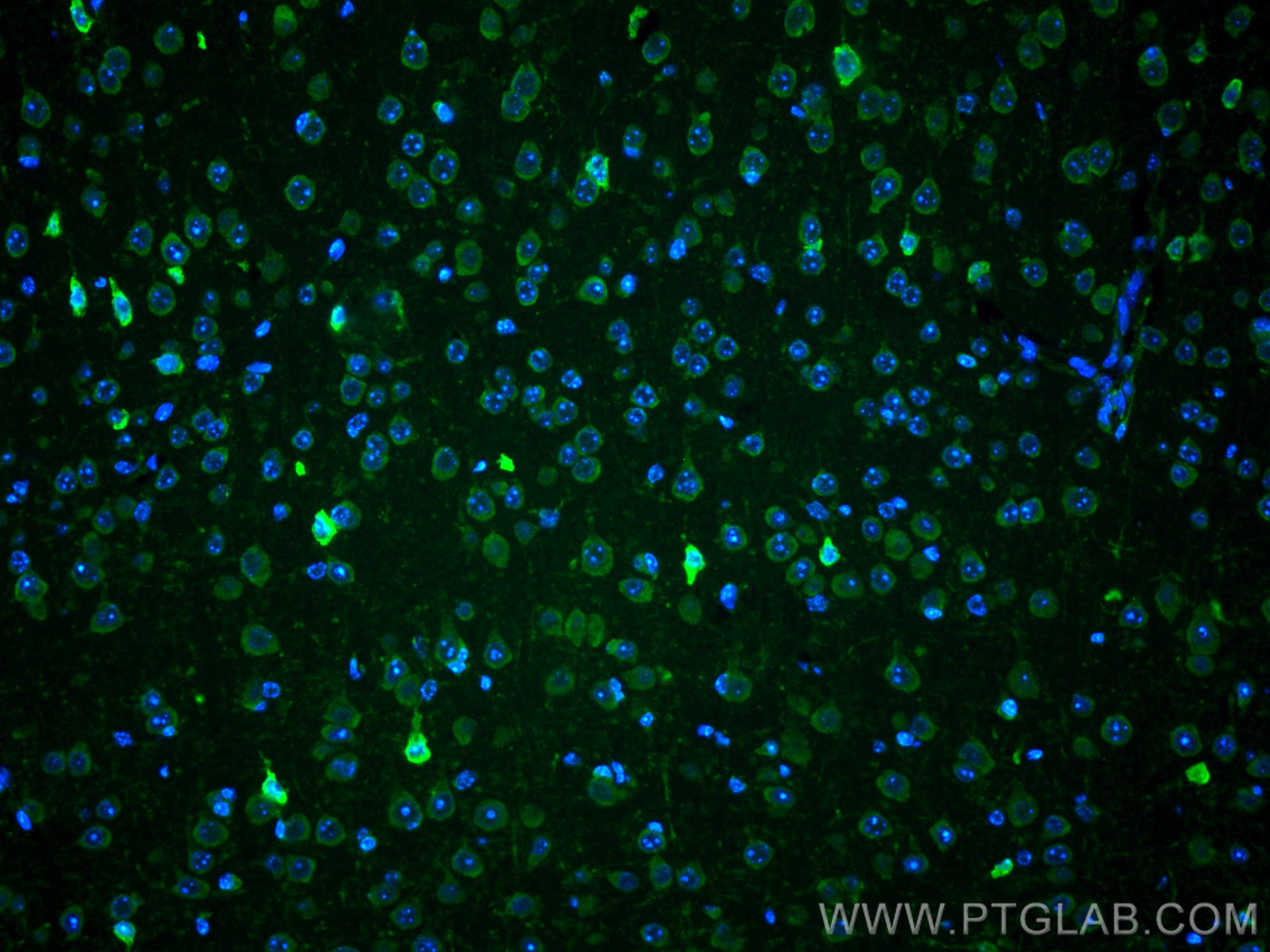 Immunofluorescence (IF) / fluorescent staining of mouse brain tissue using CoraLite® Plus 488-conjugated PARK2/Parkin Polyclo (CL488-14060)