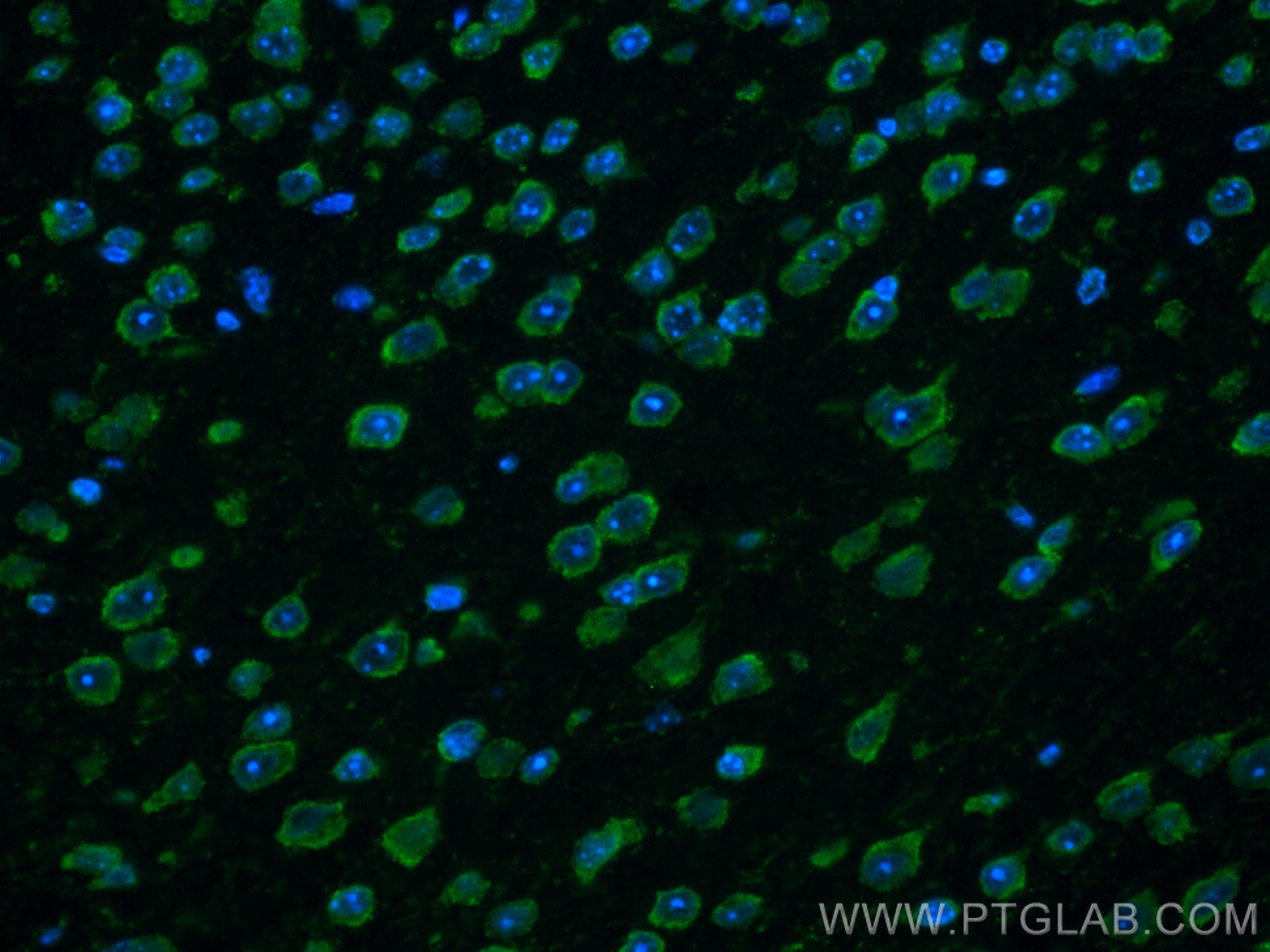 Immunofluorescence (IF) / fluorescent staining of mouse brain tissue using CoraLite® Plus 488-conjugated PARK2/Parkin Polyclo (CL488-14060)
