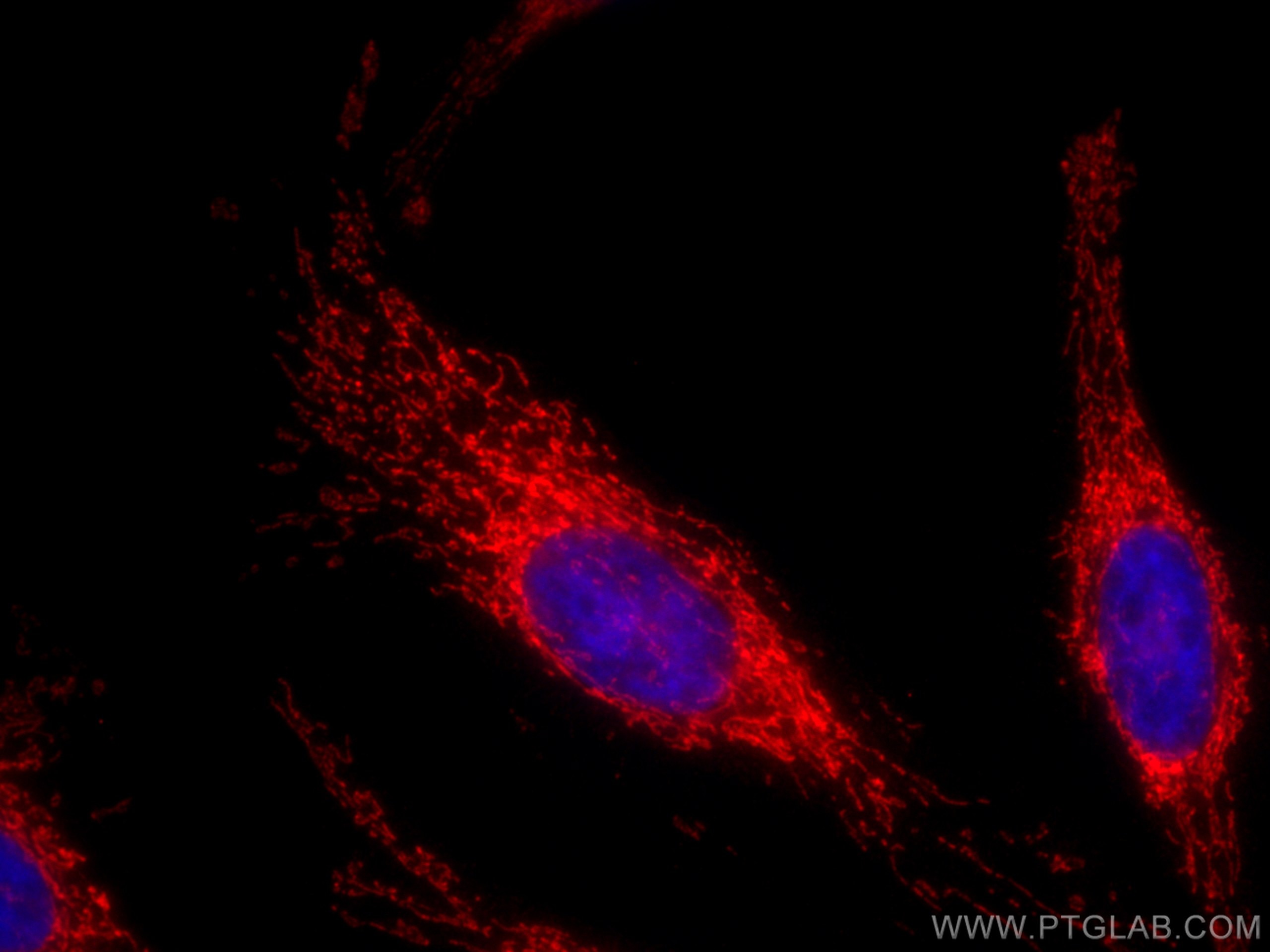 Immunofluorescence (IF) / fluorescent staining of HeLa cells using CoraLite®594-conjugated PARK2/Parkin Polyclonal an (CL594-14060)