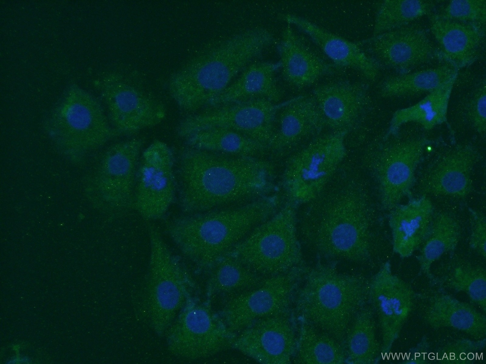 Immunofluorescence (IF) / fluorescent staining of SH-SY5Y cells using PARK7,DJ-1 Polyclonal antibody (11681-1-AP)