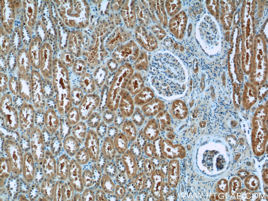 IHC staining of human kidney using 11681-1-AP