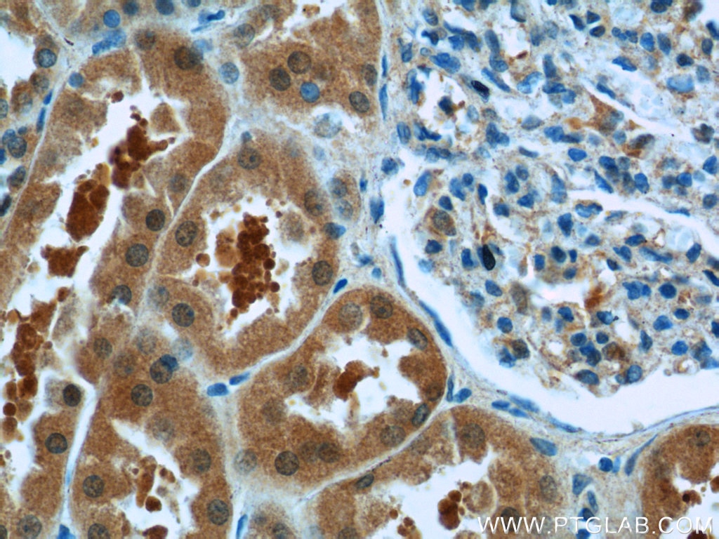 Immunohistochemistry (IHC) staining of human kidney tissue using PARK7,DJ-1 Polyclonal antibody (11681-1-AP)