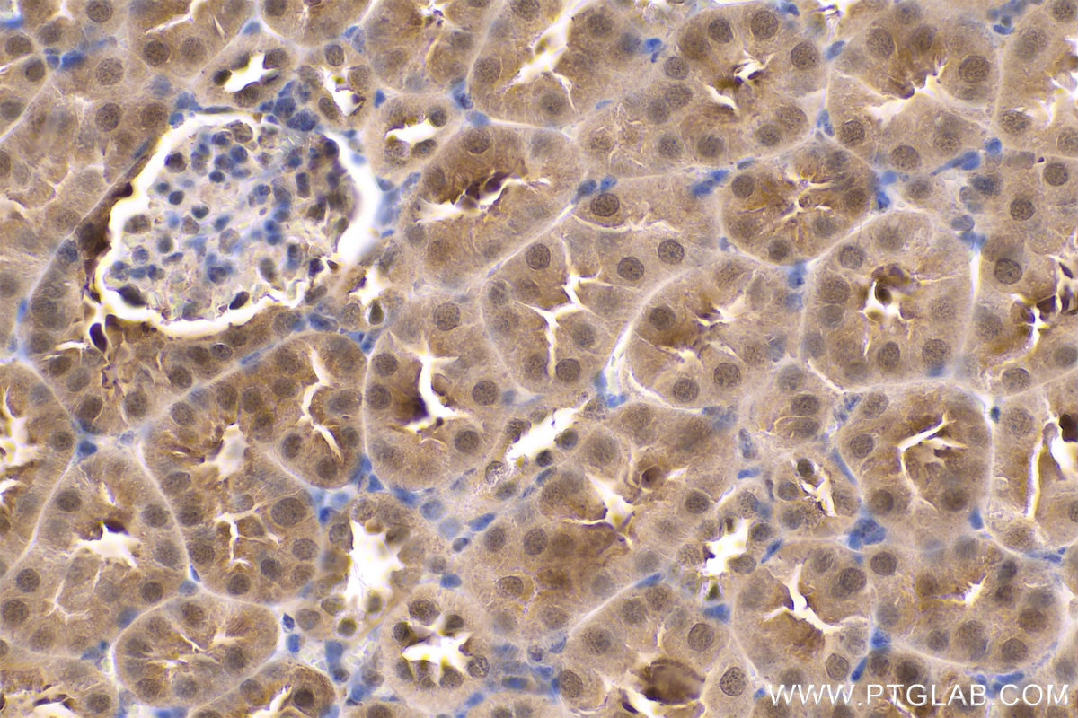 Immunohistochemistry (IHC) staining of mouse kidney tissue using PARK7,DJ-1 Polyclonal antibody (11681-1-AP)
