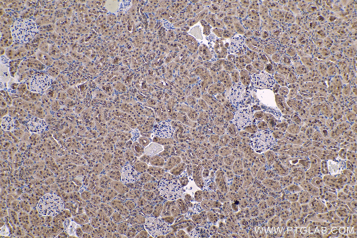 Immunohistochemistry (IHC) staining of rat kidney tissue using PARK7,DJ-1 Polyclonal antibody (11681-1-AP)