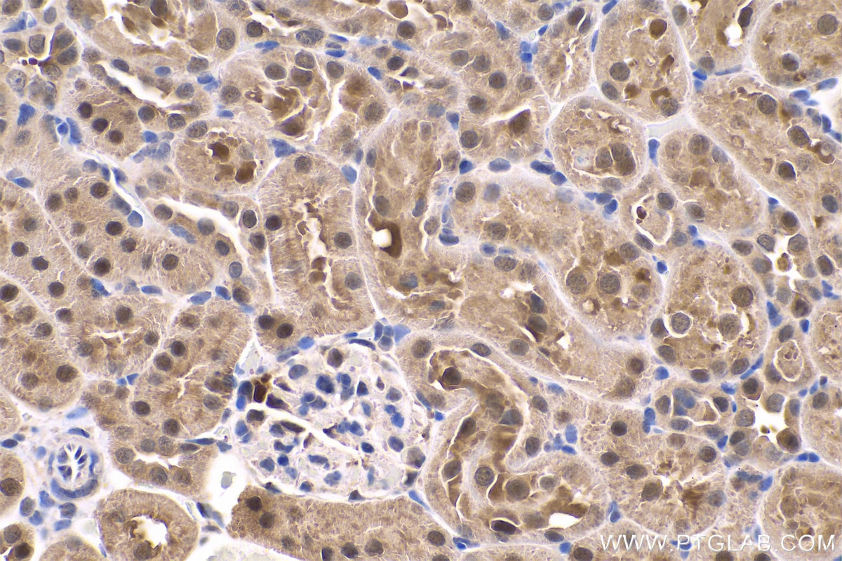 Immunohistochemistry (IHC) staining of rat kidney tissue using PARK7,DJ-1 Polyclonal antibody (11681-1-AP)