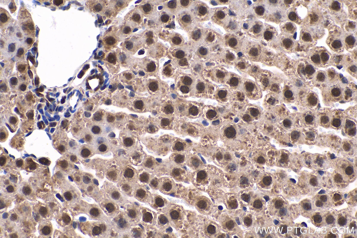 Immunohistochemistry (IHC) staining of rat liver tissue using PARK7,DJ-1 Polyclonal antibody (11681-1-AP)