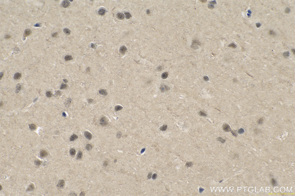 Immunohistochemistry (IHC) staining of rat brain tissue using PARK7,DJ-1 Polyclonal antibody (11681-1-AP)
