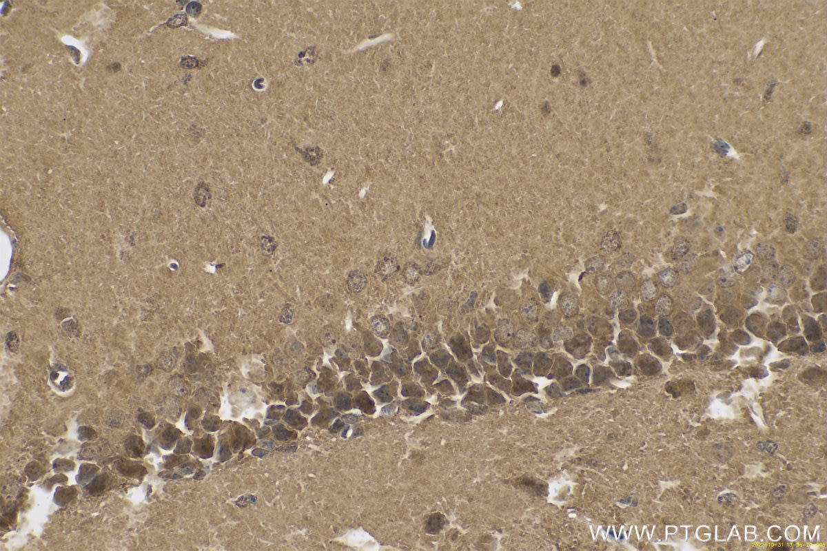 Immunohistochemistry (IHC) staining of mouse brain tissue using PARK7,DJ-1 Polyclonal antibody (11681-1-AP)
