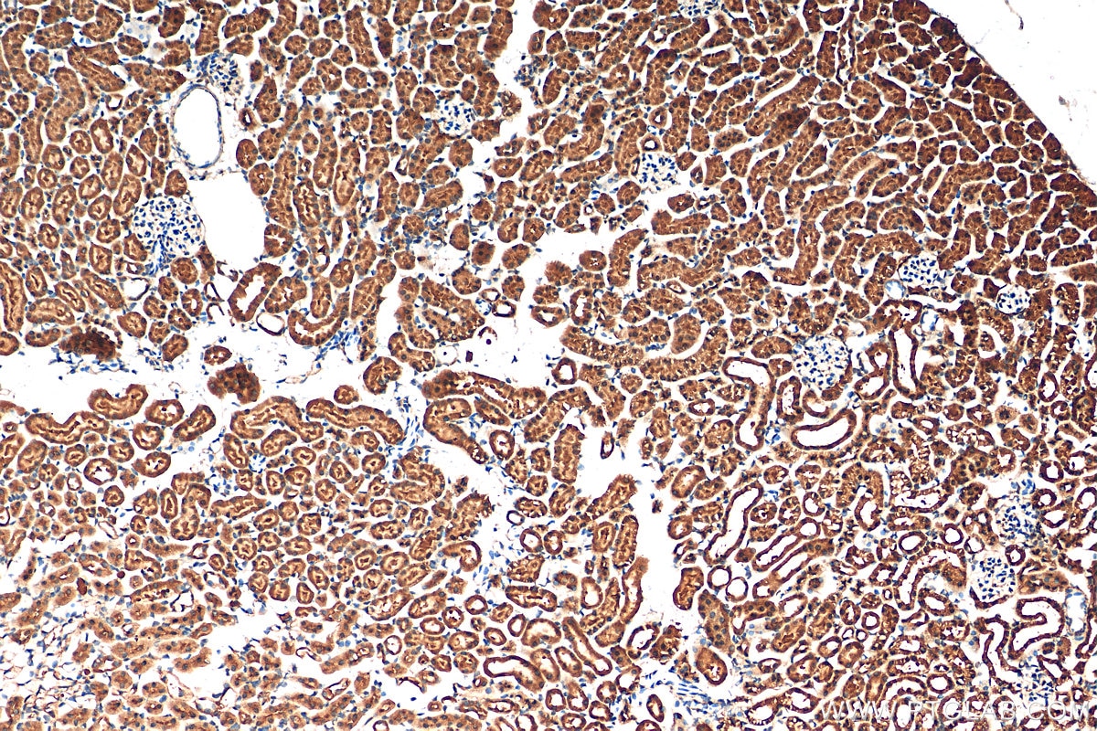 Immunohistochemistry (IHC) staining of mouse kidney tissue using PARK7,DJ-1 Polyclonal antibody (11681-1-AP)