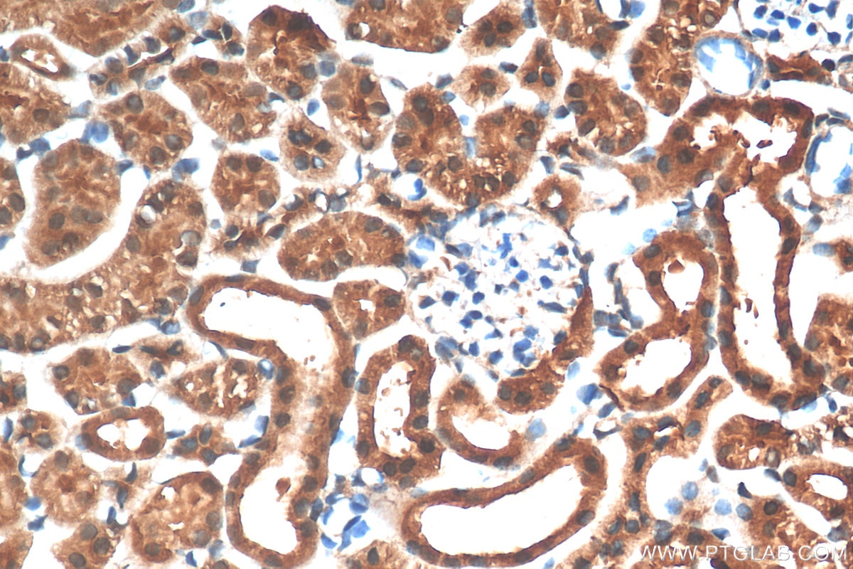 Immunohistochemistry (IHC) staining of mouse kidney tissue using PARK7,DJ-1 Polyclonal antibody (11681-1-AP)