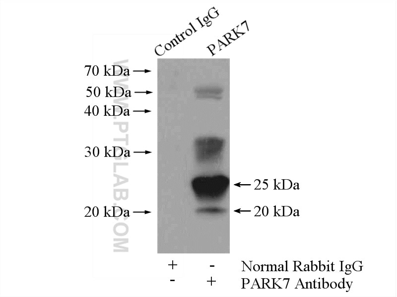Immunoprecipitation (IP) experiment of HeLa cells using PARK7,DJ-1 Polyclonal antibody (11681-1-AP)