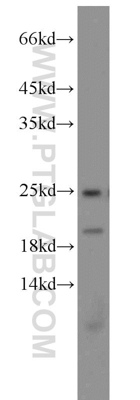 Western Blot (WB) analysis of Jurkat cells using PARK7,DJ-1 Polyclonal antibody (11681-1-AP)