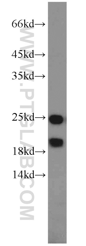 Western Blot (WB) analysis of HeLa cells using PARK7,DJ-1 Polyclonal antibody (11681-1-AP)