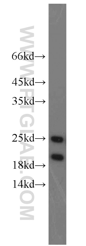 Western Blot (WB) analysis of HEK-293 cells using PARK7,DJ-1 Polyclonal antibody (11681-1-AP)