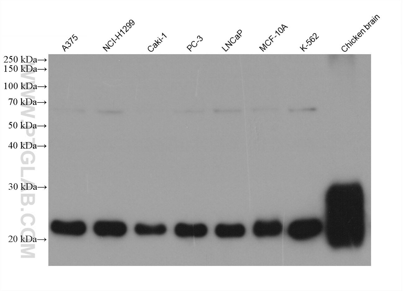 Western Blot (WB) analysis of various lysates using PARK7/DJ-1 Monoclonal antibody (68915-6-Ig)