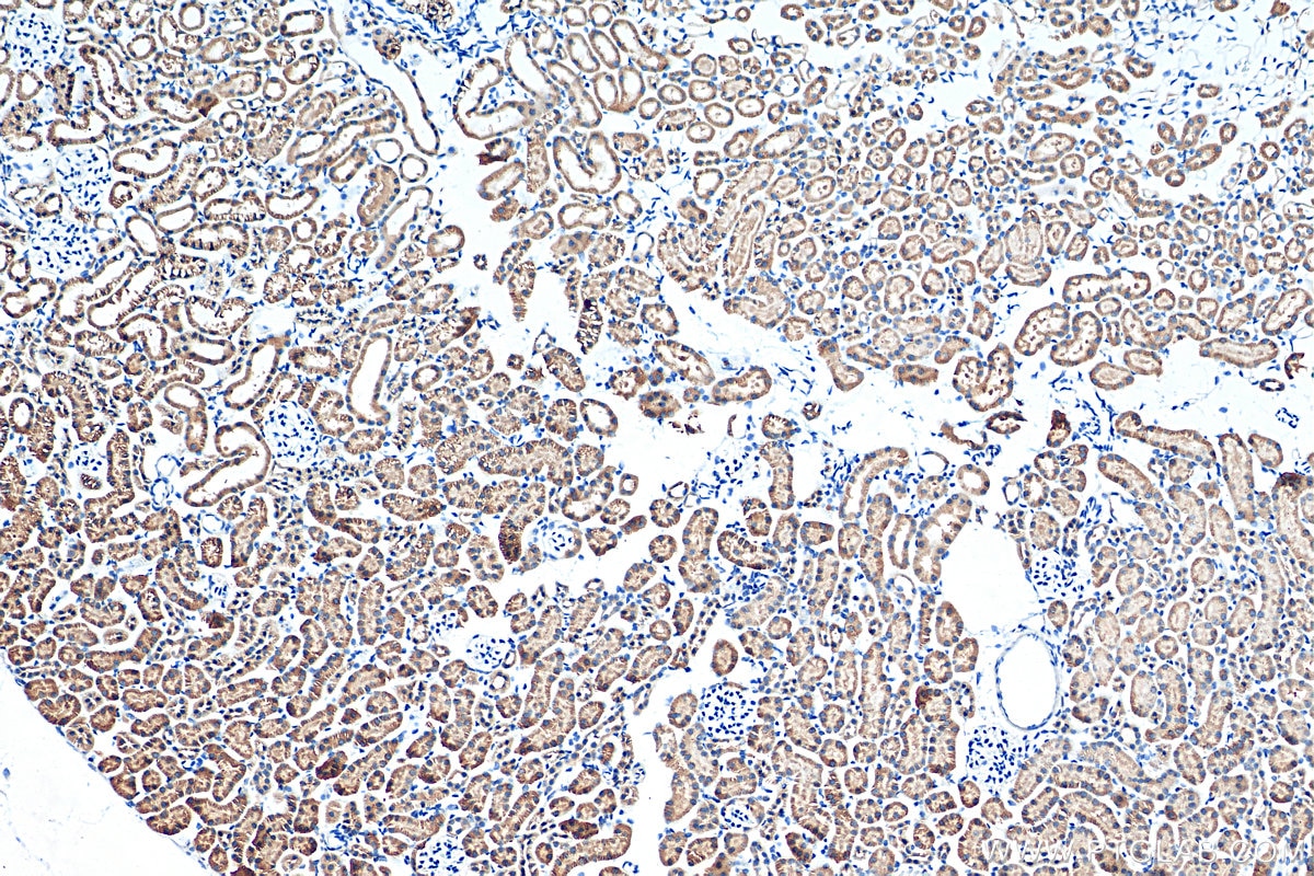 Immunohistochemistry (IHC) staining of mouse kidney tissue using Biotin-conjugated PARK7,DJ-1 Polyclonal antibody (Biotin-11681)